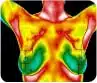 Breast Thermography 2 brest.jpg