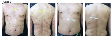 Miracle Water Hydrogen-Infused | Increasing list of Health Benefits for Chronic Illness 4 bathstudy.png