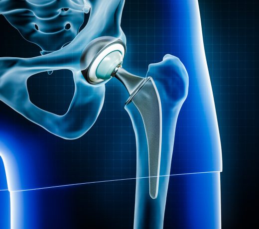 QGYOF60AwULvmu4k25r9